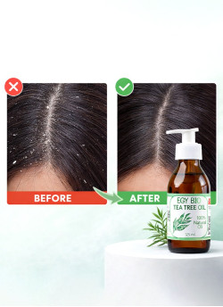 (B45)ايجي بيو زيت شجره الشاي ٥٠ مل