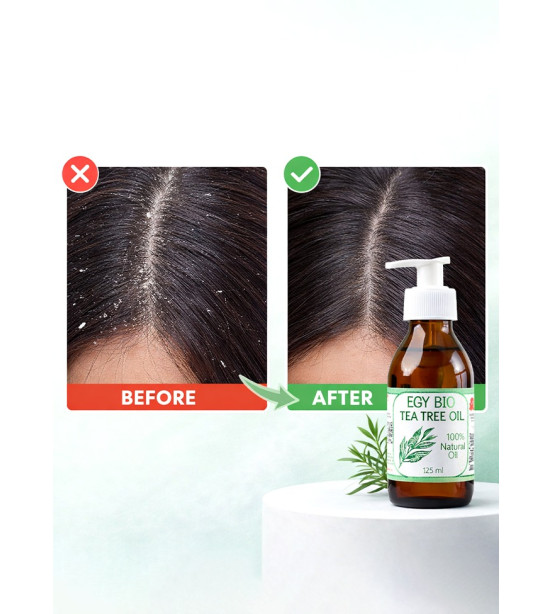 (B46)ايجي بيو زيت شجره الشاي ١٢٥ مل