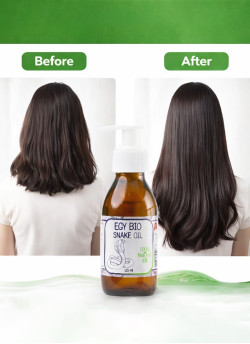 (B33) ايجى بيو زيت الحيه ٥٠ مل