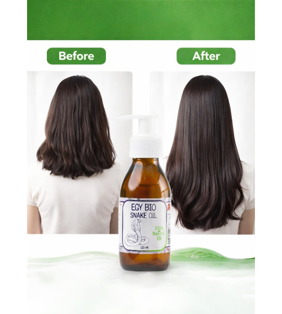 (B33) ايجى بيو زيت الحيه ٥٠ مل